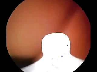 Camera prevalent fertile cervix